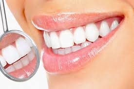 Отбеливание зубов – некоторые нюансы